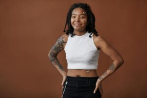 Why Acne Positivity Matters for Long-Term Skin Confidence - Featured image