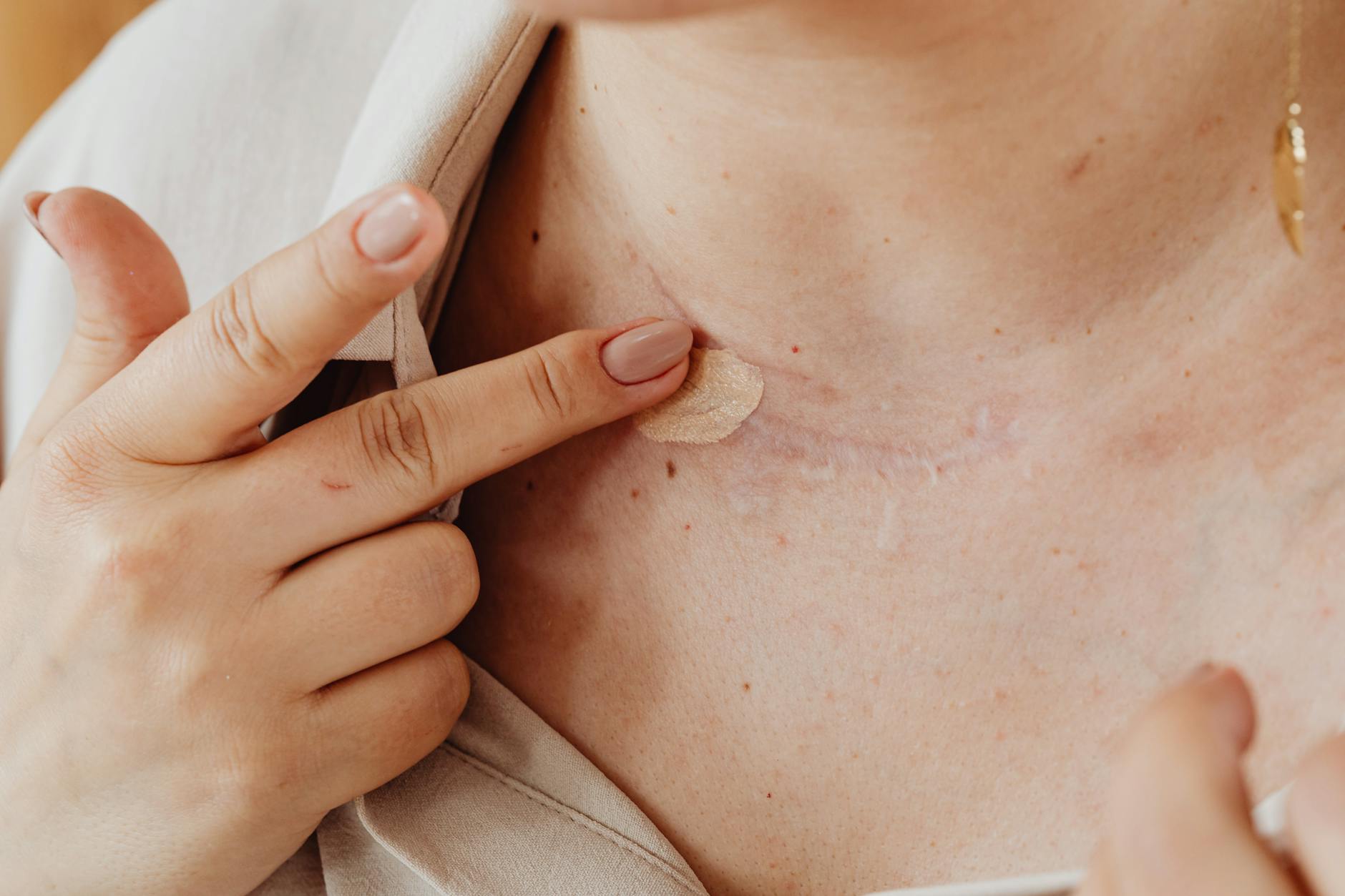 Why Acne Scar Consultation Includes Photography and Lighting Assessment - Featured image