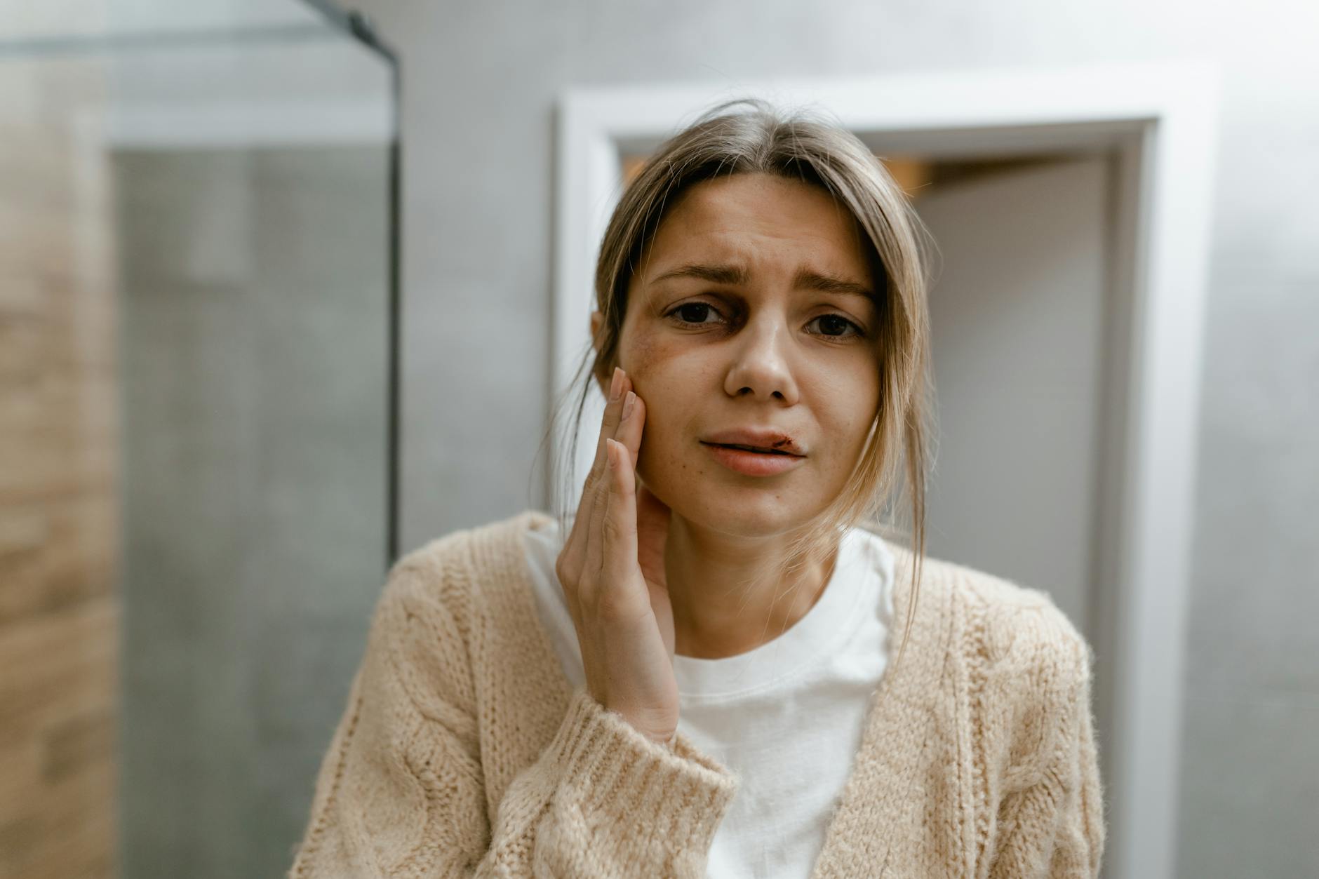 Why Anticoagulants Affect Bruising During Acne Scar Subcision - Featured image
