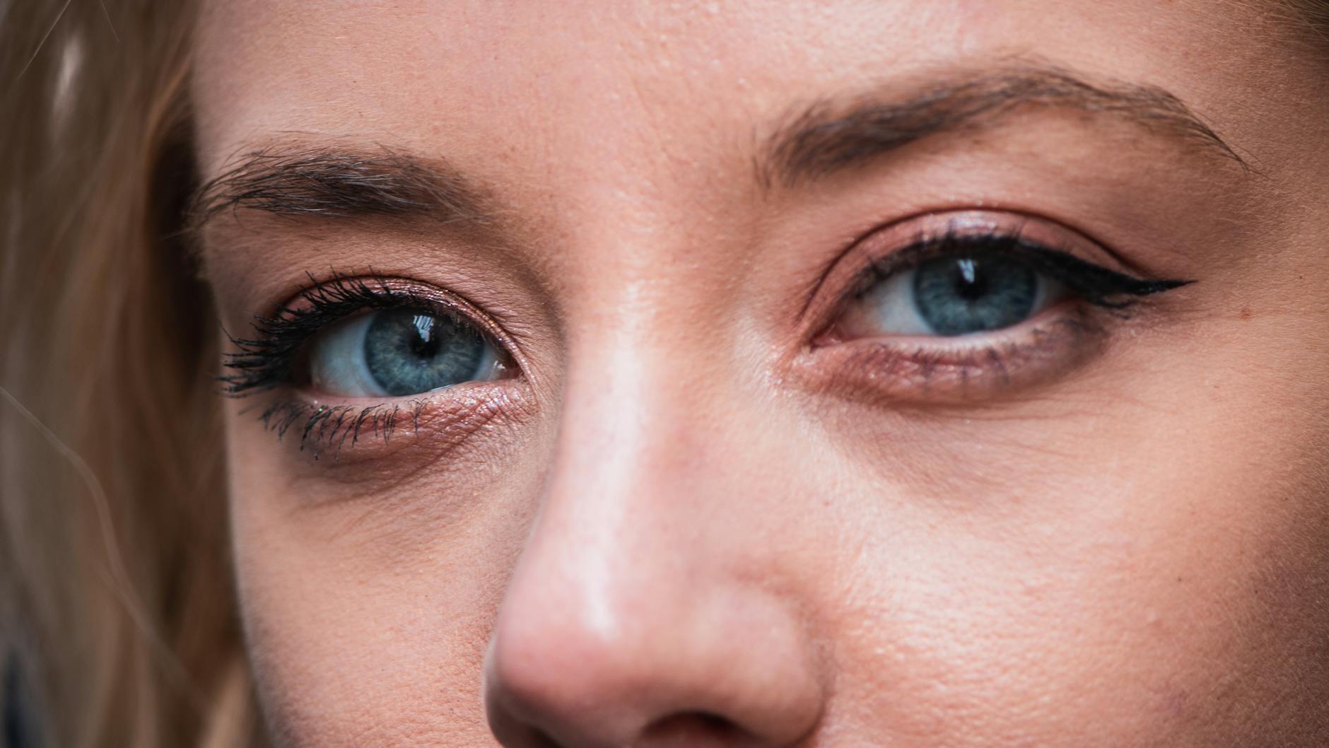 Why Are Celebrities Building Acne-Focused Skincare Brands?