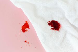 Why Benzoyl Peroxide Is Bleaching Your Towels - Featured image