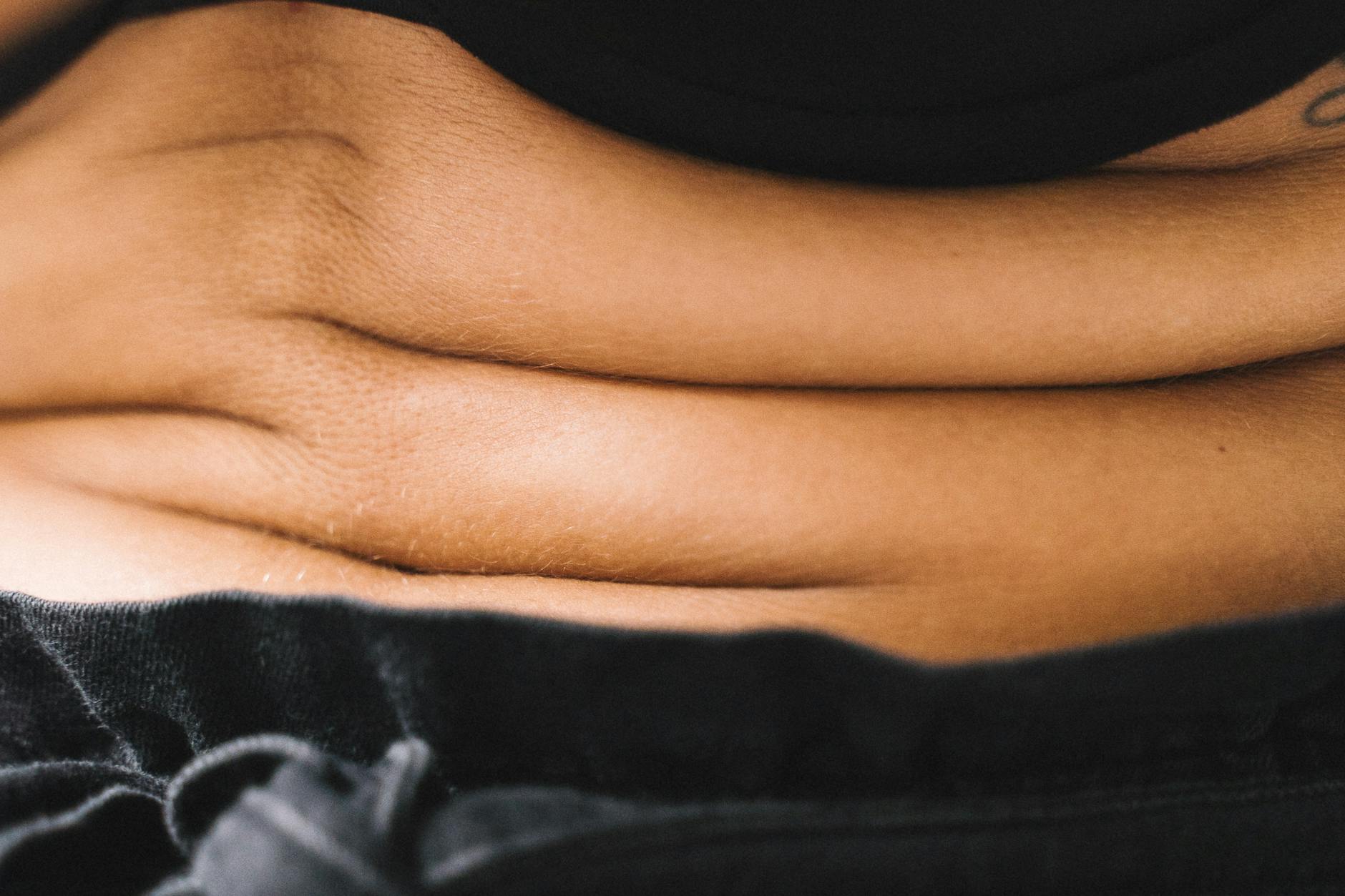 Why BodyTite Is Sometimes Used for Severe Back Acne Scarring - Featured image
