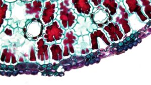 Why Bone Marrow Stem Cell Research Is Relevant to Acne Scars - Featured image