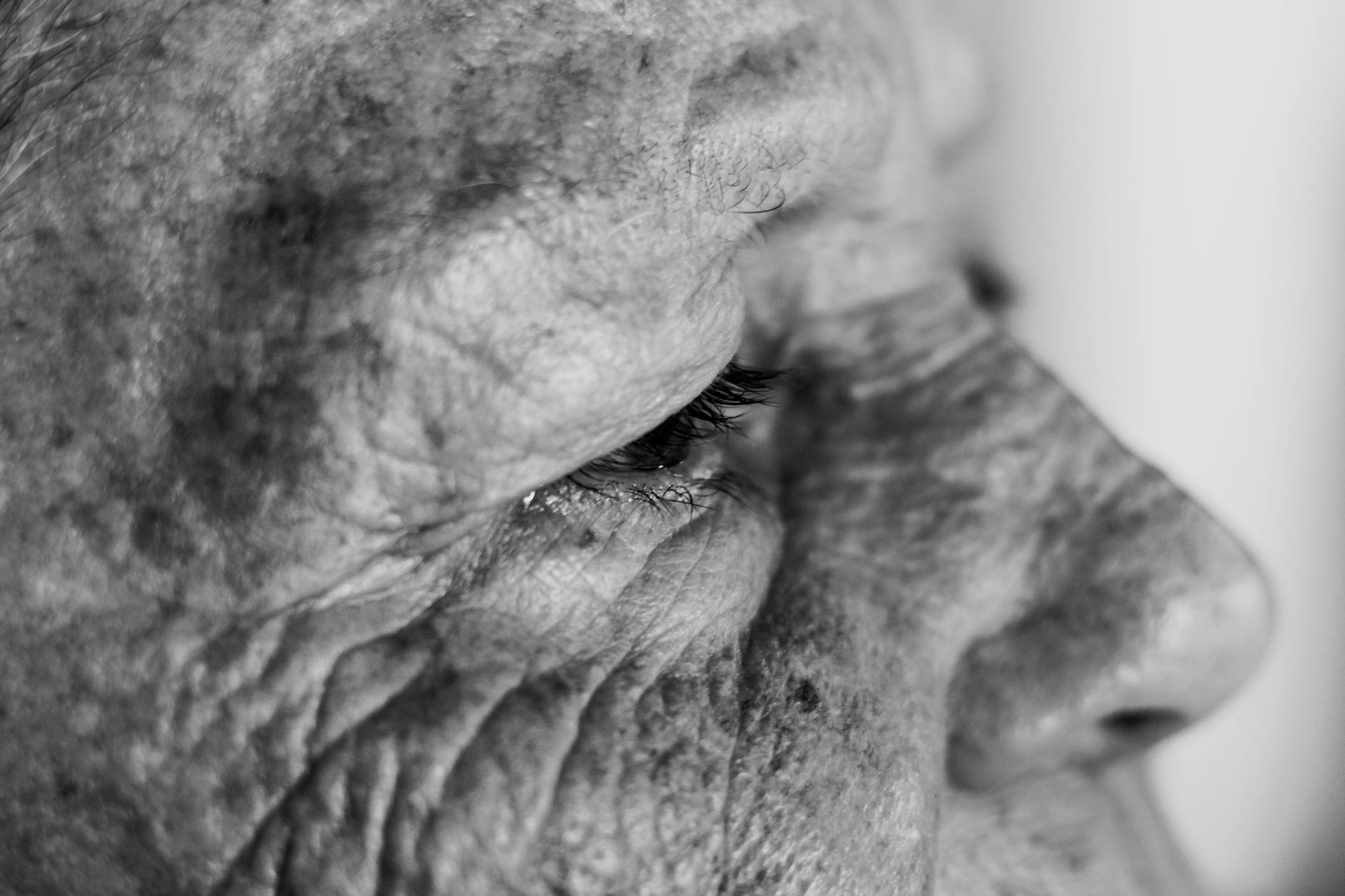 Why Certain Ages Experience Much Higher Acne Rates