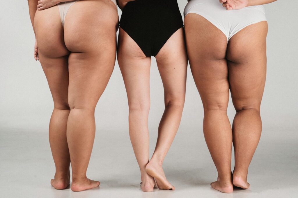 Why Collagen Type I vs III Ratio Affects Acne Scar Appearance - Featured image