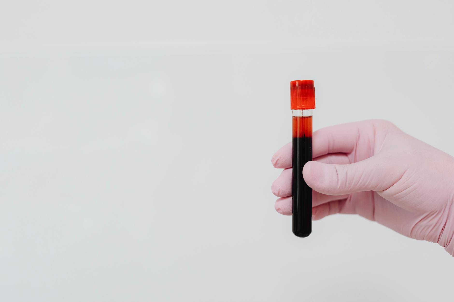 Why Dermatologists Order Androgen Blood Tests for Stubborn Acne - Featured image