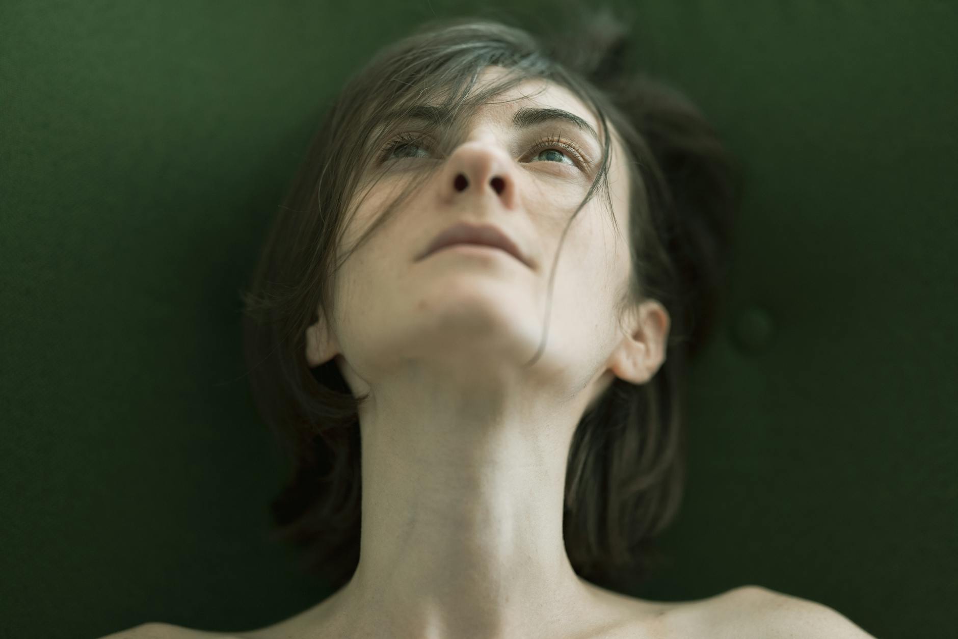 Why Does Clindamycin Alone Fail to Control Acne Long-Term?