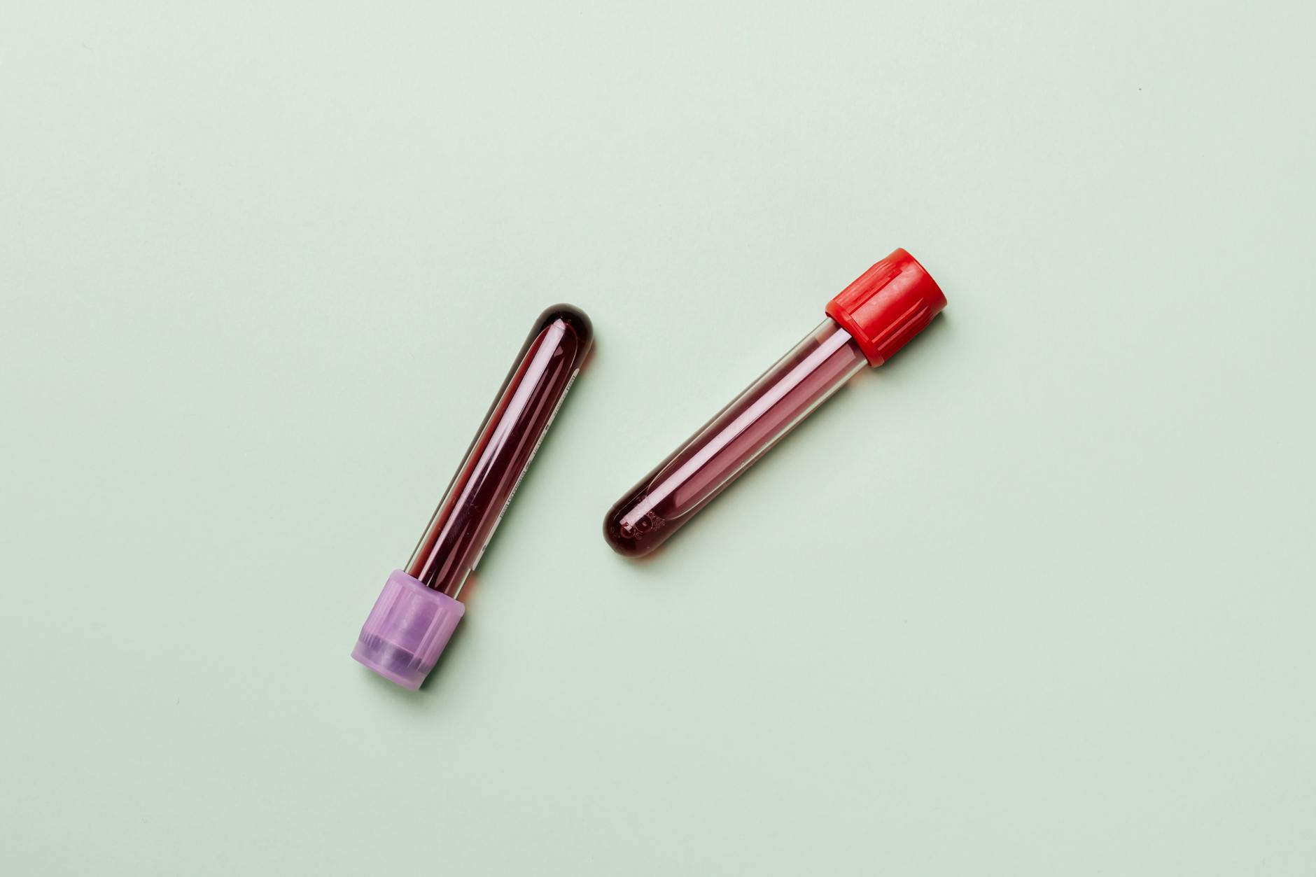 Why DUTCH Complete Test Is Preferred Over Saliva for Acne Hormones - Featured image