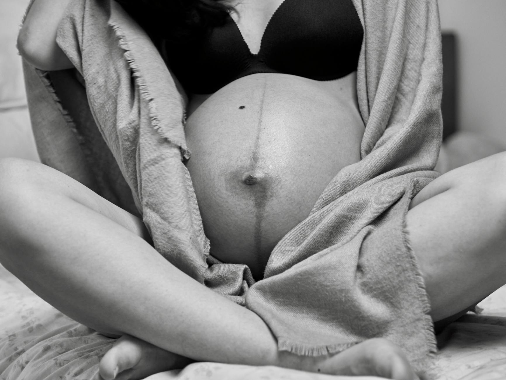 Why Female Acne Patients Need Pregnancy Tests Monthly on Accutane - Featured image