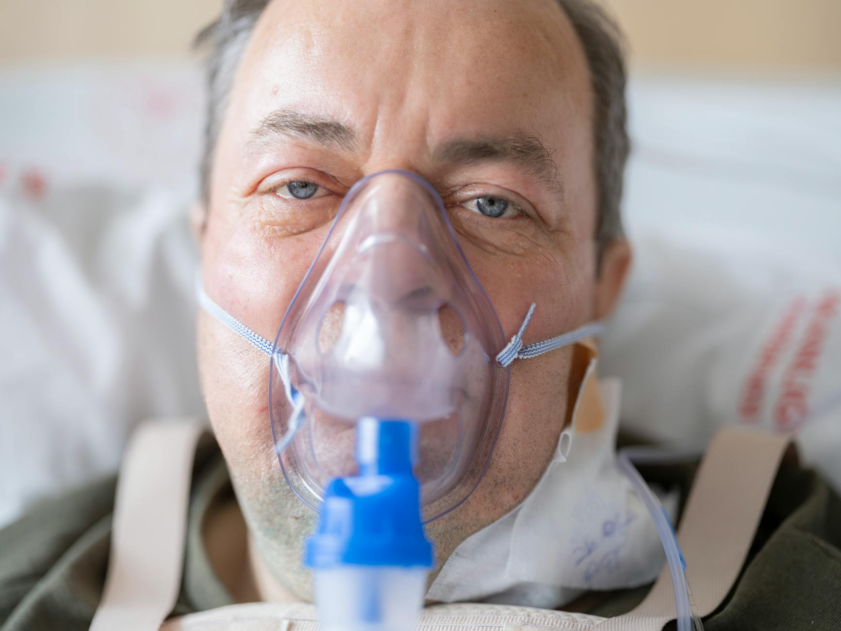 Why Hyperbaric Oxygen Therapy Is Sometimes Used for Acne Healing - Featured image