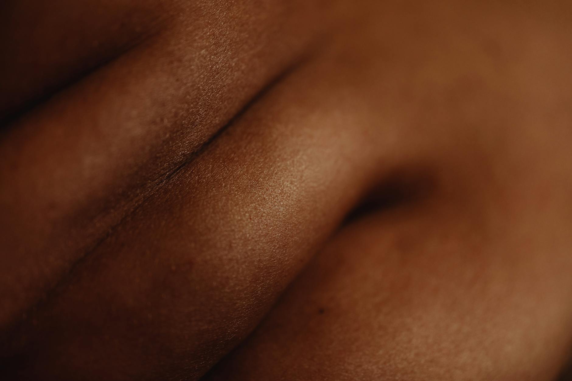 Why Is Acne-Prone Skin Fundamentally Different at the Bacterial Level?