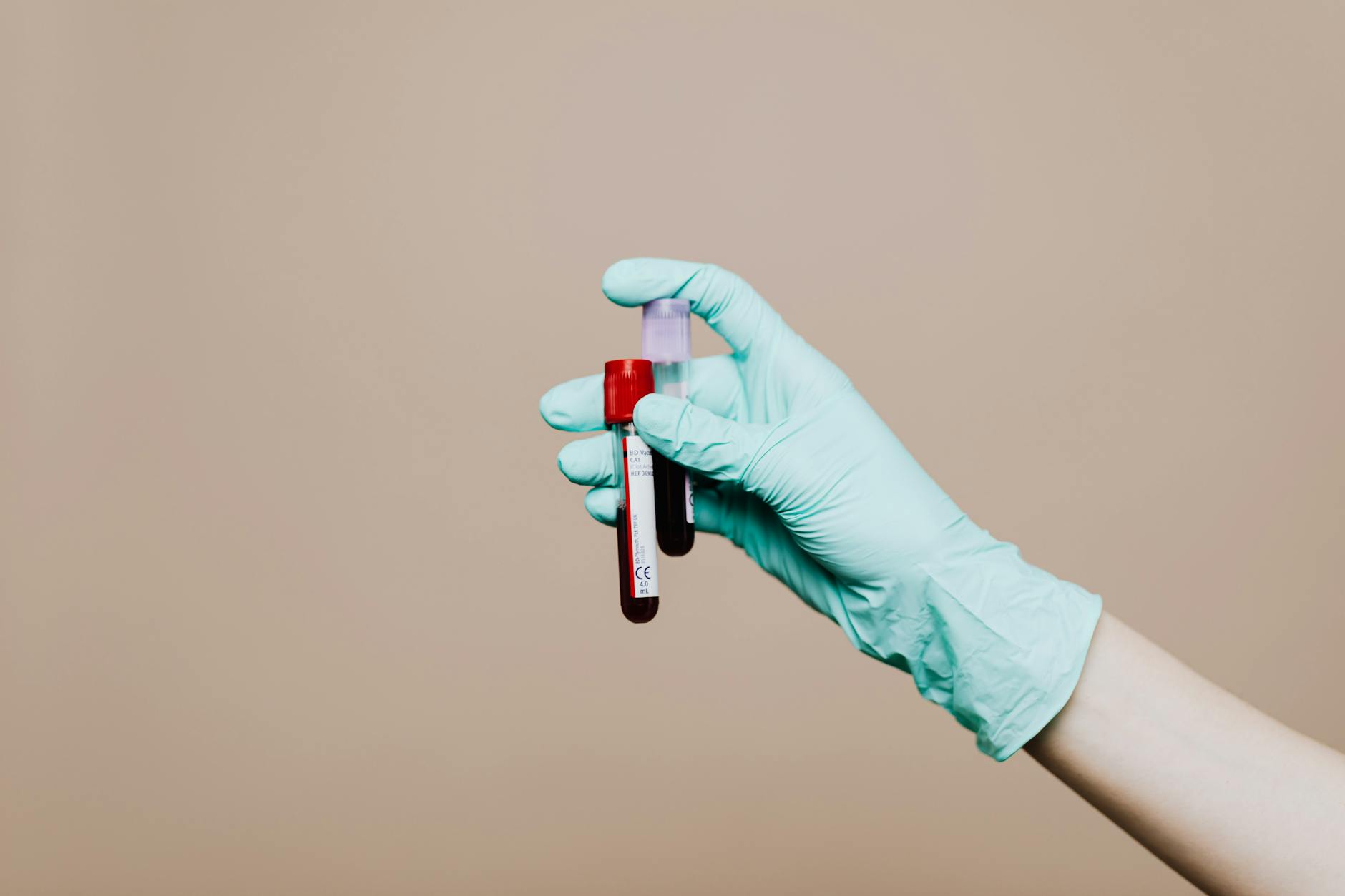 Why Normal Blood Results Don't Rule Out Hormonal Acne