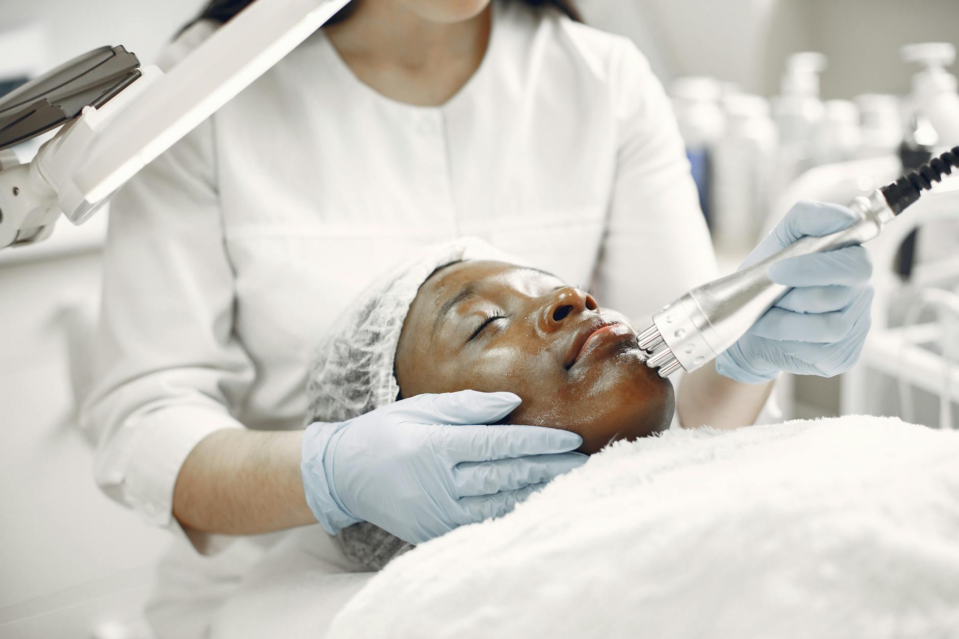 Why Post-Inflammatory Hyperpigmentation After Laser Is Treatable - Featured image