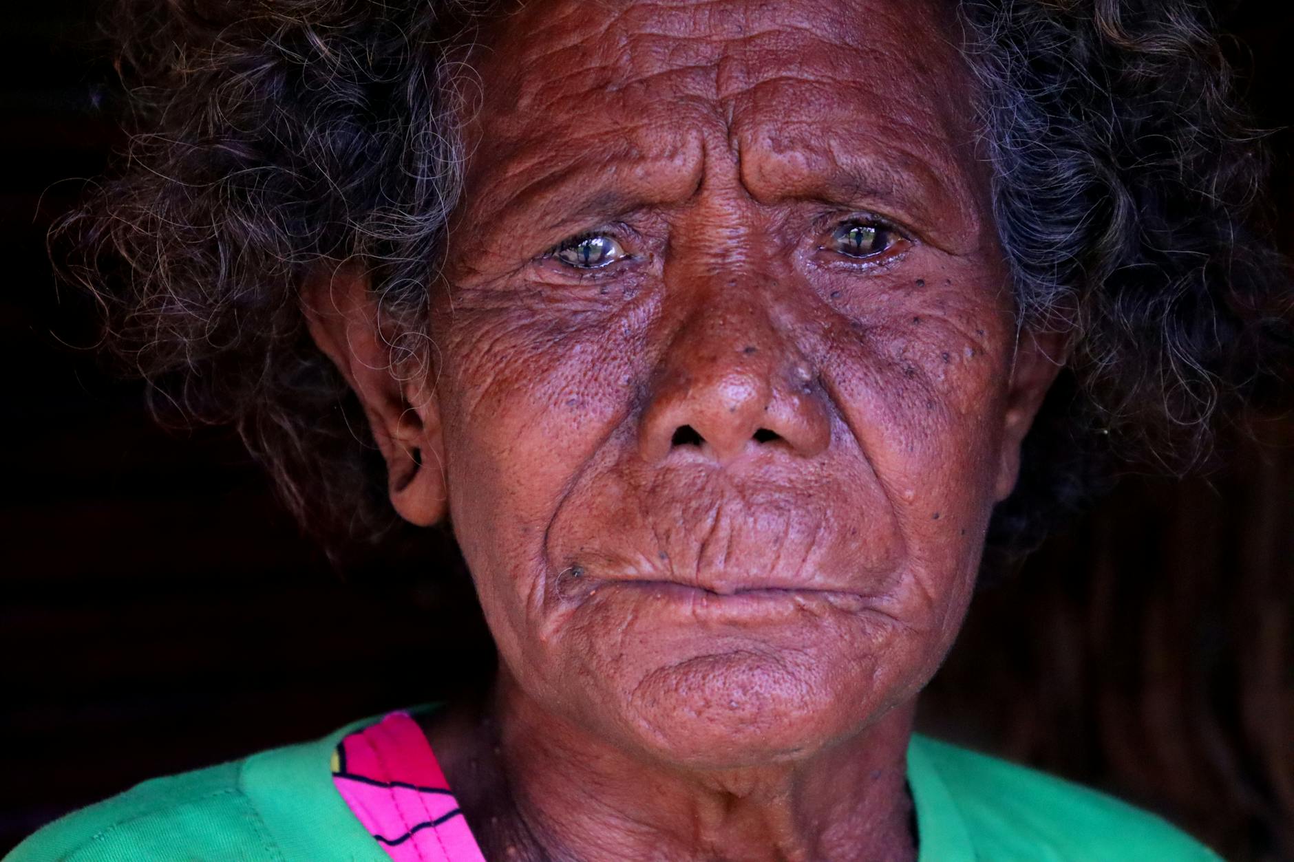 Why Real-Life Skin Challenges Are Driving New Acne Product Innovation