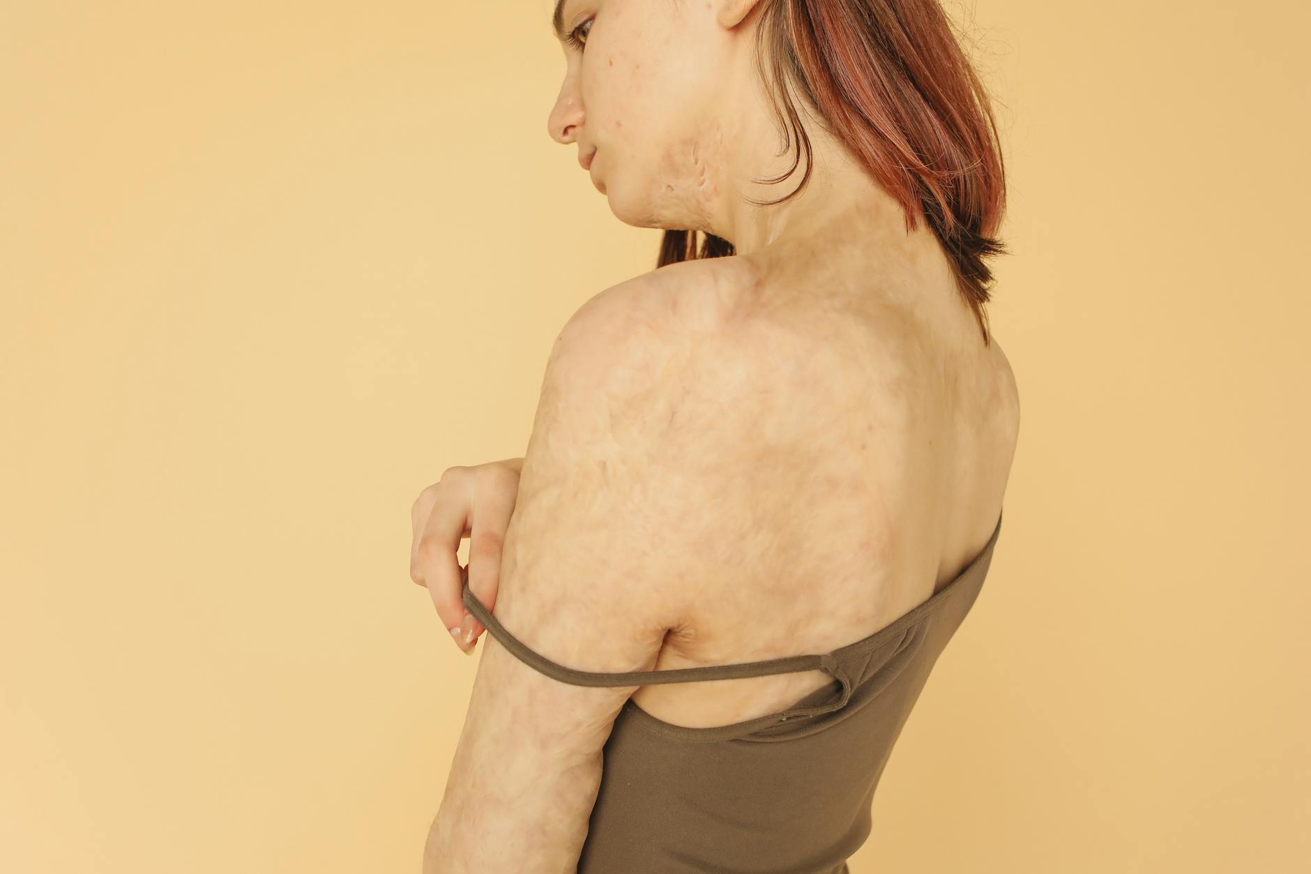 Why Skin Healing Depends on Proper Care and Patience - Featured image