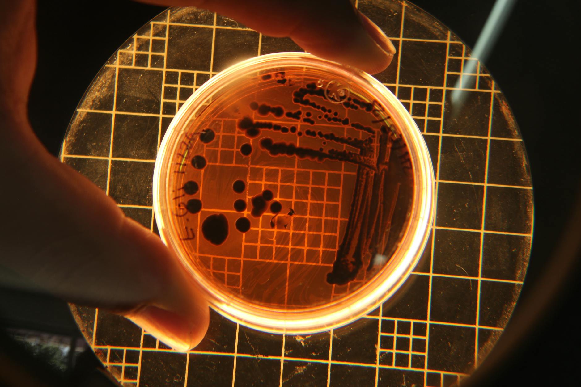 Why Stem Cell Conditioned Media Works for Acne Healing - Featured image