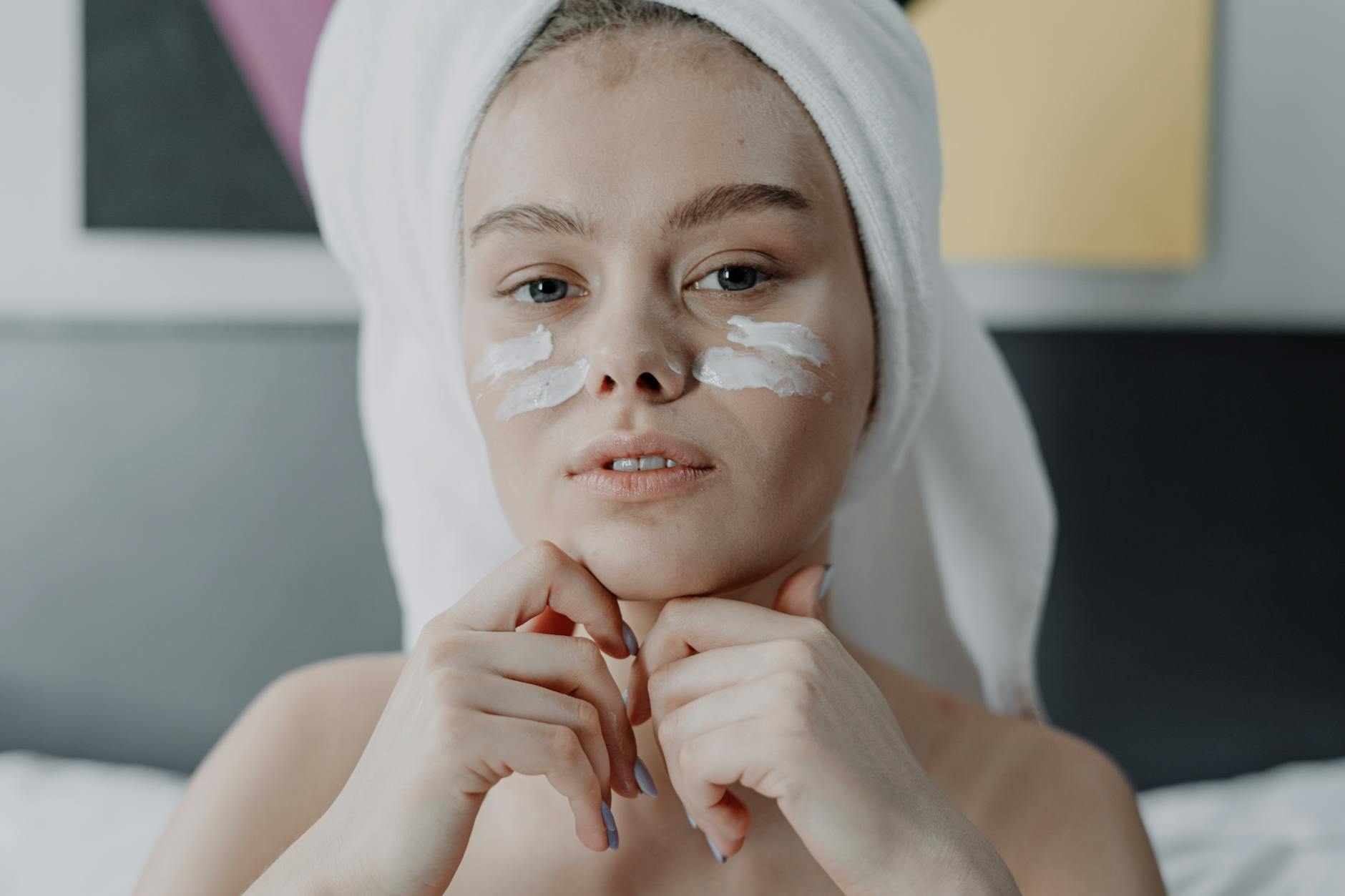 Challenges and Limitations in Treating Hard Water Acne