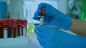 New Anti-IL-17 Biologic in Clinical Trials...Originally for Psoriasis Shows Unexpected Benefit for Nodulocystic Acne - Featured image