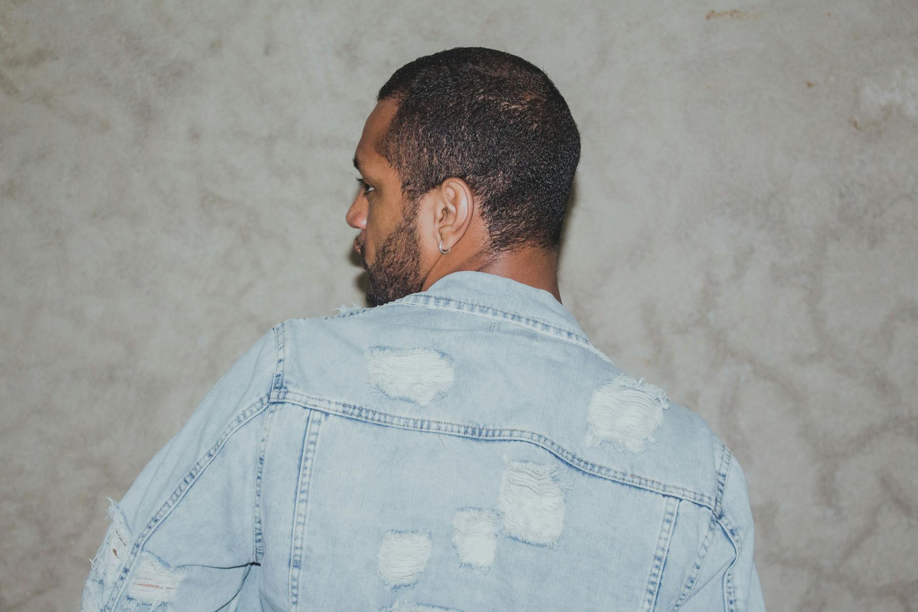 Why Do Men With Back Acne Develop Severe Scars and How Does Professional Treatment Help?