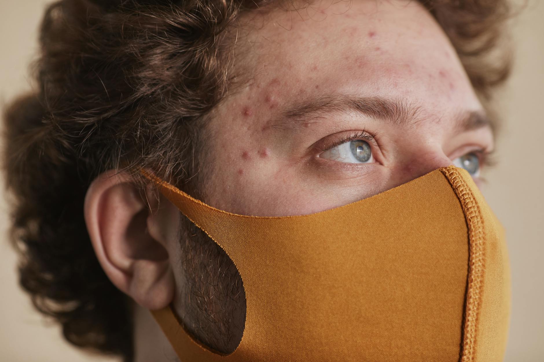 At Least 20% of Athletes With Acne Believe That Their Skin Purge From Retinoids Should Not Last Longer Than 8 Weeks - Featured image