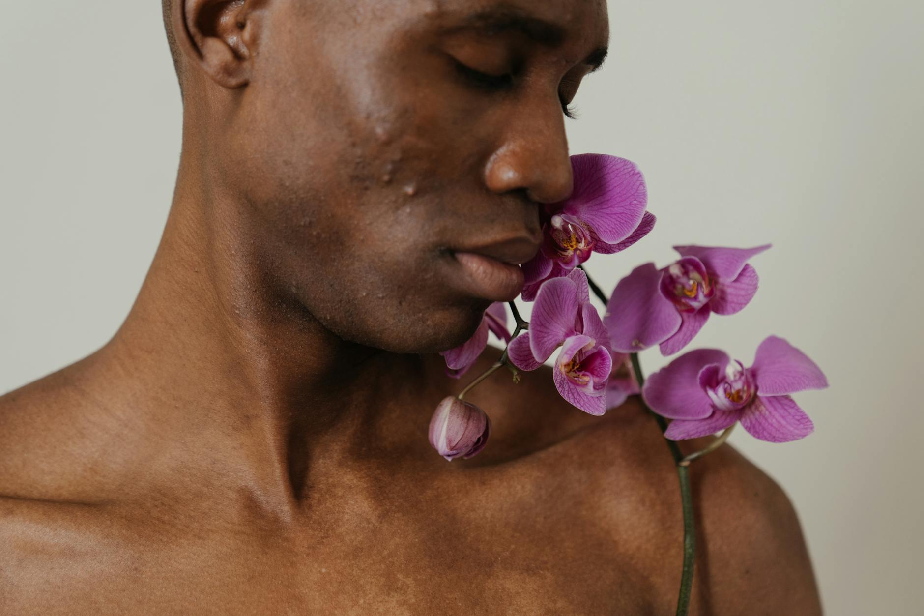At Least 22% of Patients With Body Acne Have Never Been Told That Biotin Supplements Have Been Linked to Cystic Breakouts - Featured image