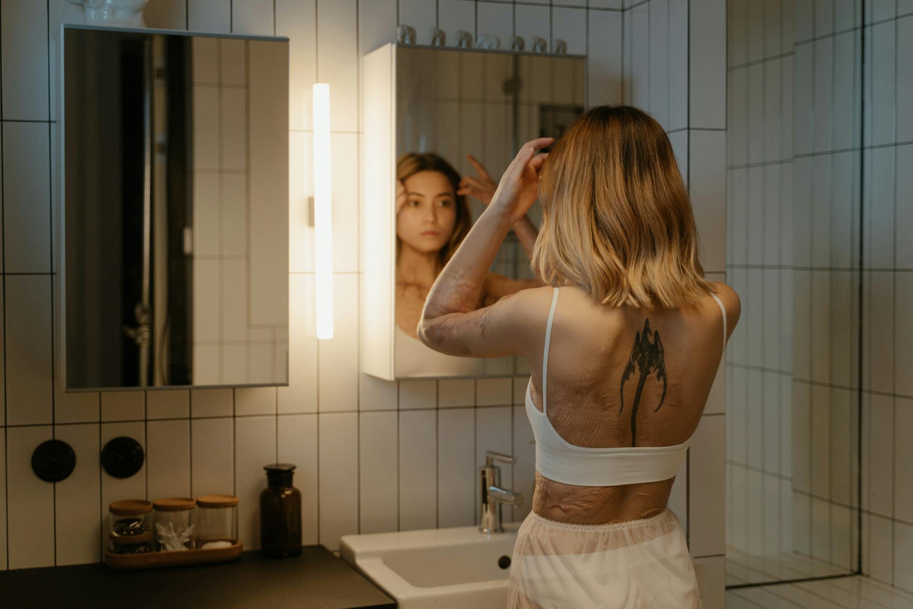 At Least 43% of People With Acne Scars Would Benefit From Knowing That Sunscreen Is Essential While Using Any Acne Medication - Featured image