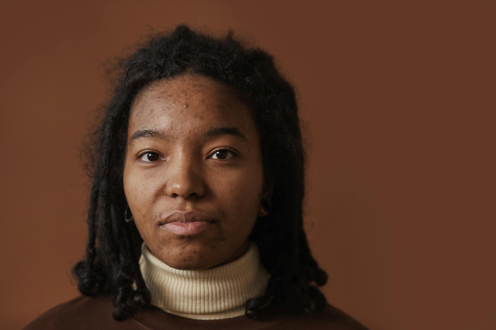 At Least 80% of Women Over 40 With Acne Would Benefit From Knowing That A Simple 3-Step Routine Is More Effective Than a 10-Step Routine - Featured image