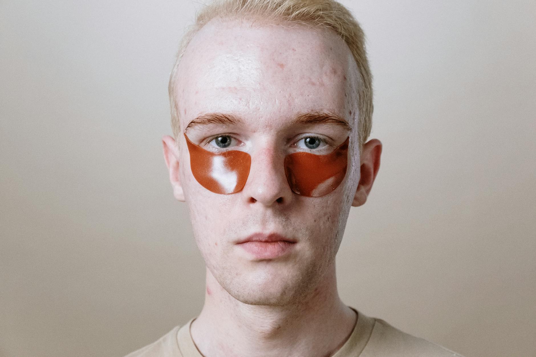 At Least 83% of Men With Back Acne Report That Stress Directly Increases Sebum Production Through Cortisol - Featured image