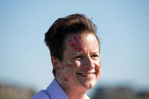 At Least 86% of Trans Men on Testosterone Don't Realize That Hormonal Testing Could Identify the Root Cause of Their Acne - Featured image