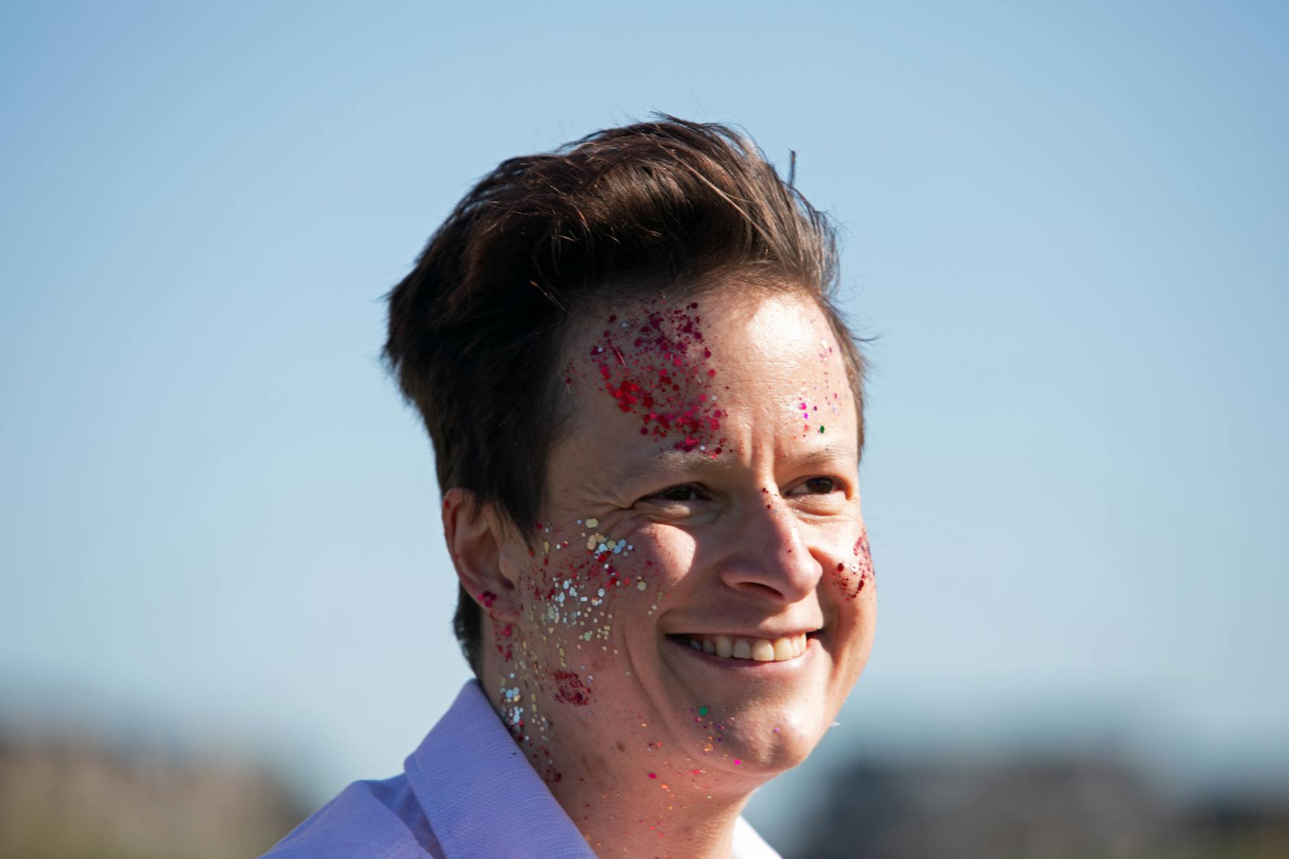 At Least 86% of Trans Men on Testosterone Don't Realize That Hormonal Testing Could Identify the Root Cause of Their Acne - Featured image