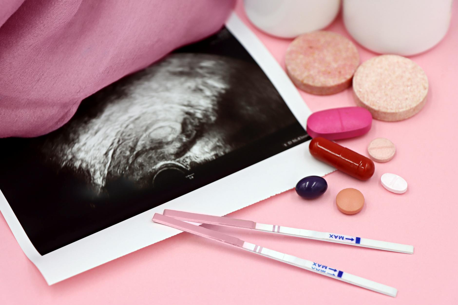 Can Hormonal Testing Actually Identify Why Accutane Patients Developed Acne?