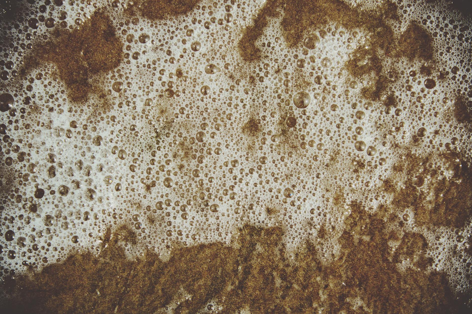 Can Laundry Detergent Cause Skin Irritation and Worsen Acne?