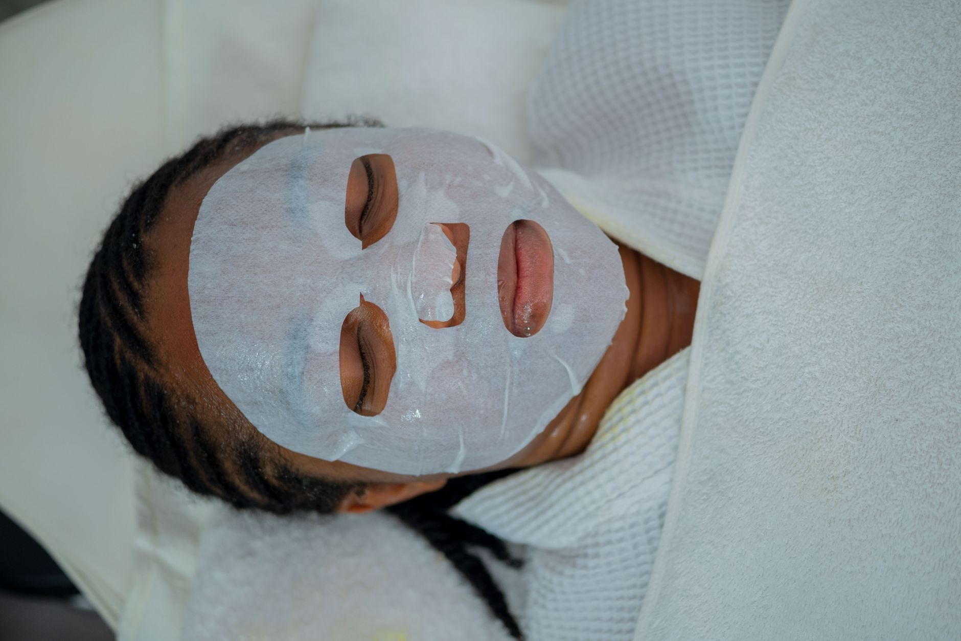 Common Mistakes in Treating Fungal Acne