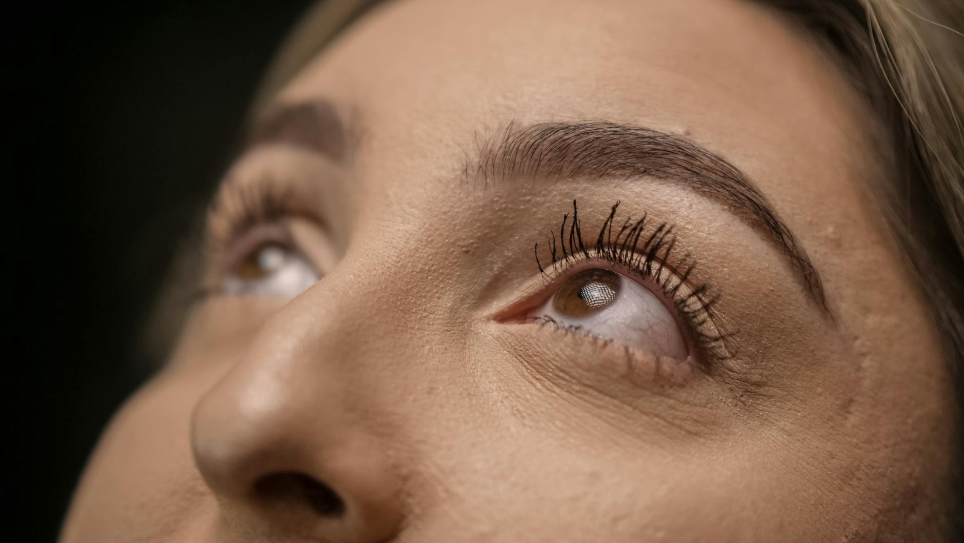 Does Tretinoin Really Increase Collagen Production in Acne-Prone Skin?