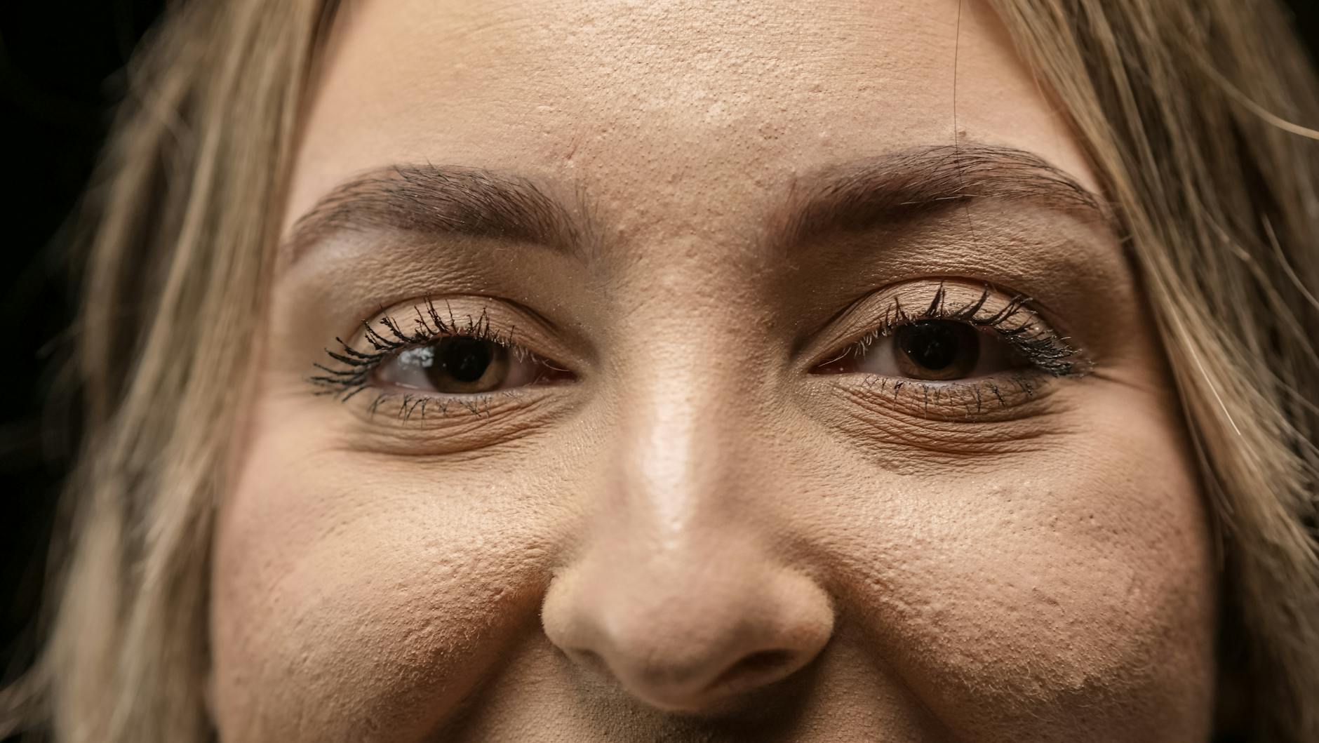 How Does Tretinoin Increase Collagen Production and Thicken Skin?