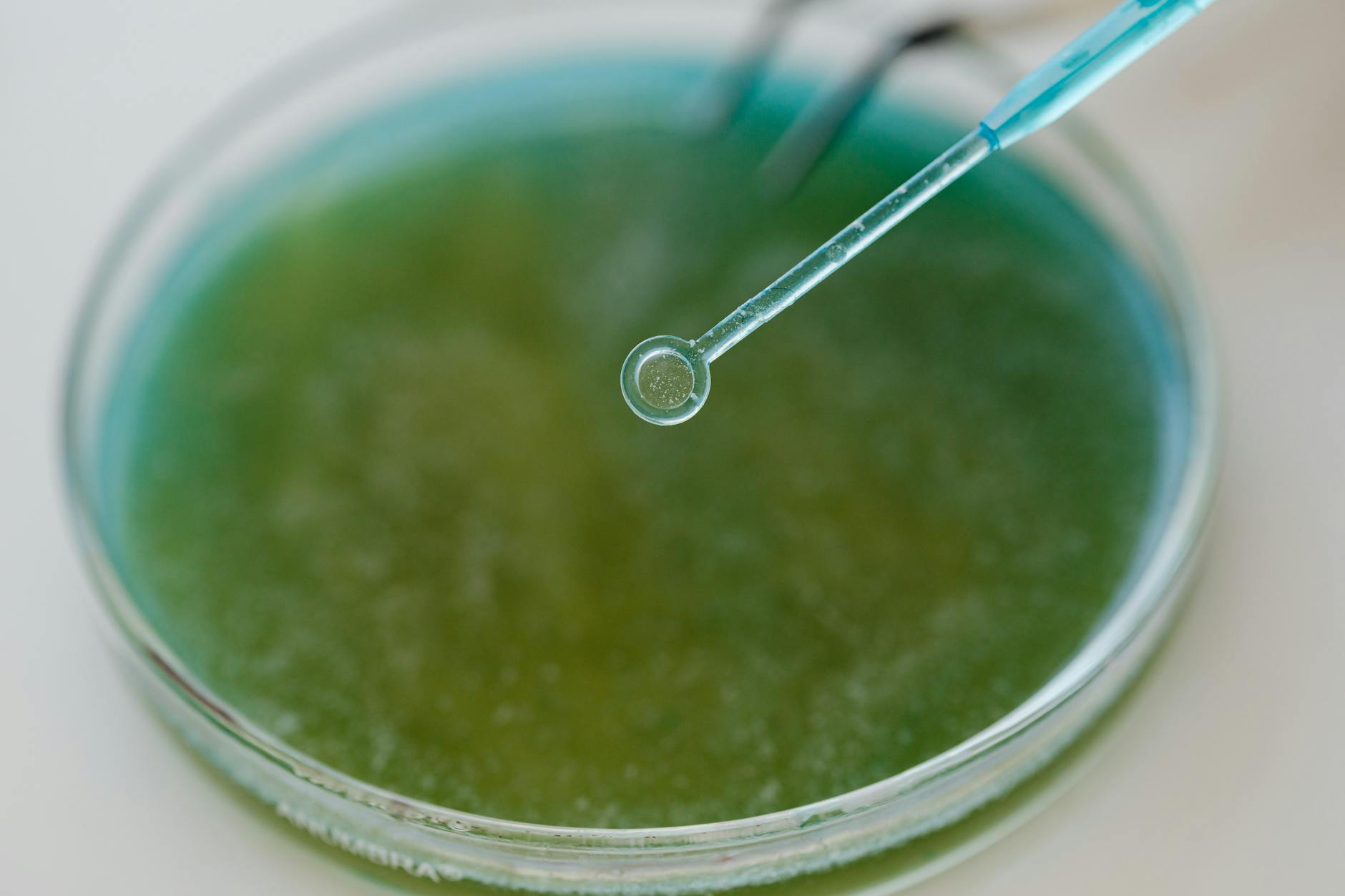 How Much Bacteria Actually Live on Your Phone Screen Compared to a Toilet Seat?