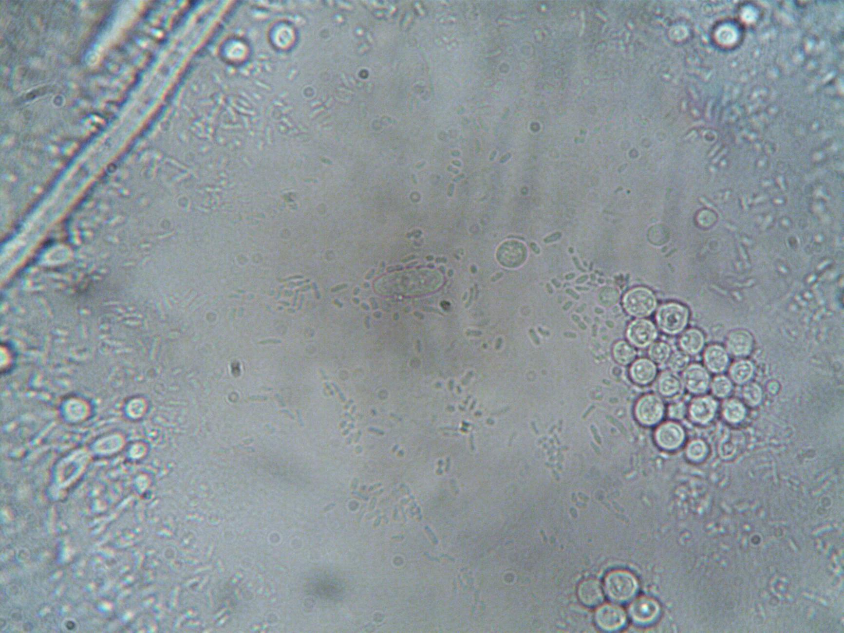 How Much Bacteria Live on Your Phone Compared to a Toilet Seat?