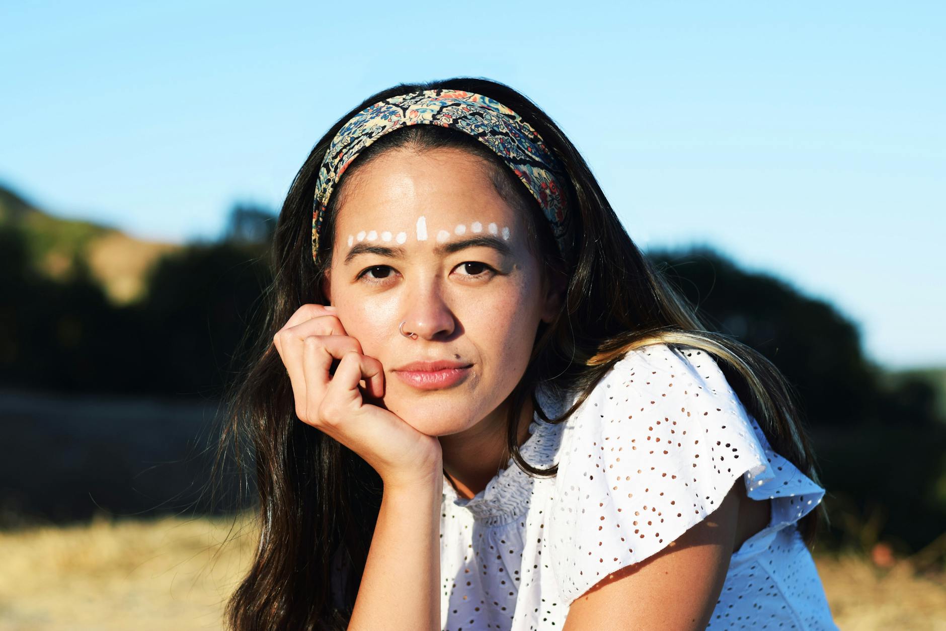 Understanding the Specific Pattern of Forehead and Temple Breakouts