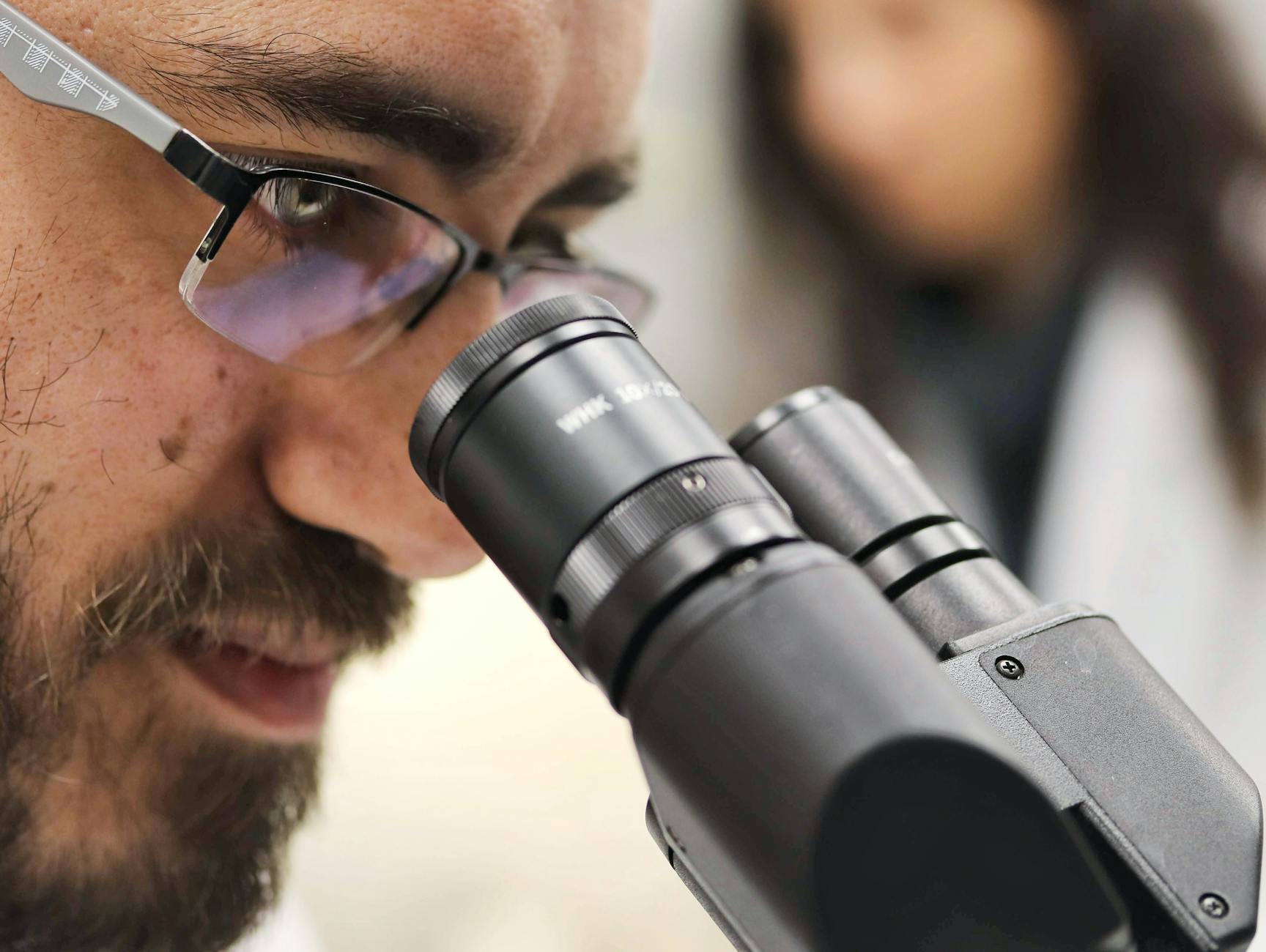 What Research Shows About Diet's Role in Acne Development