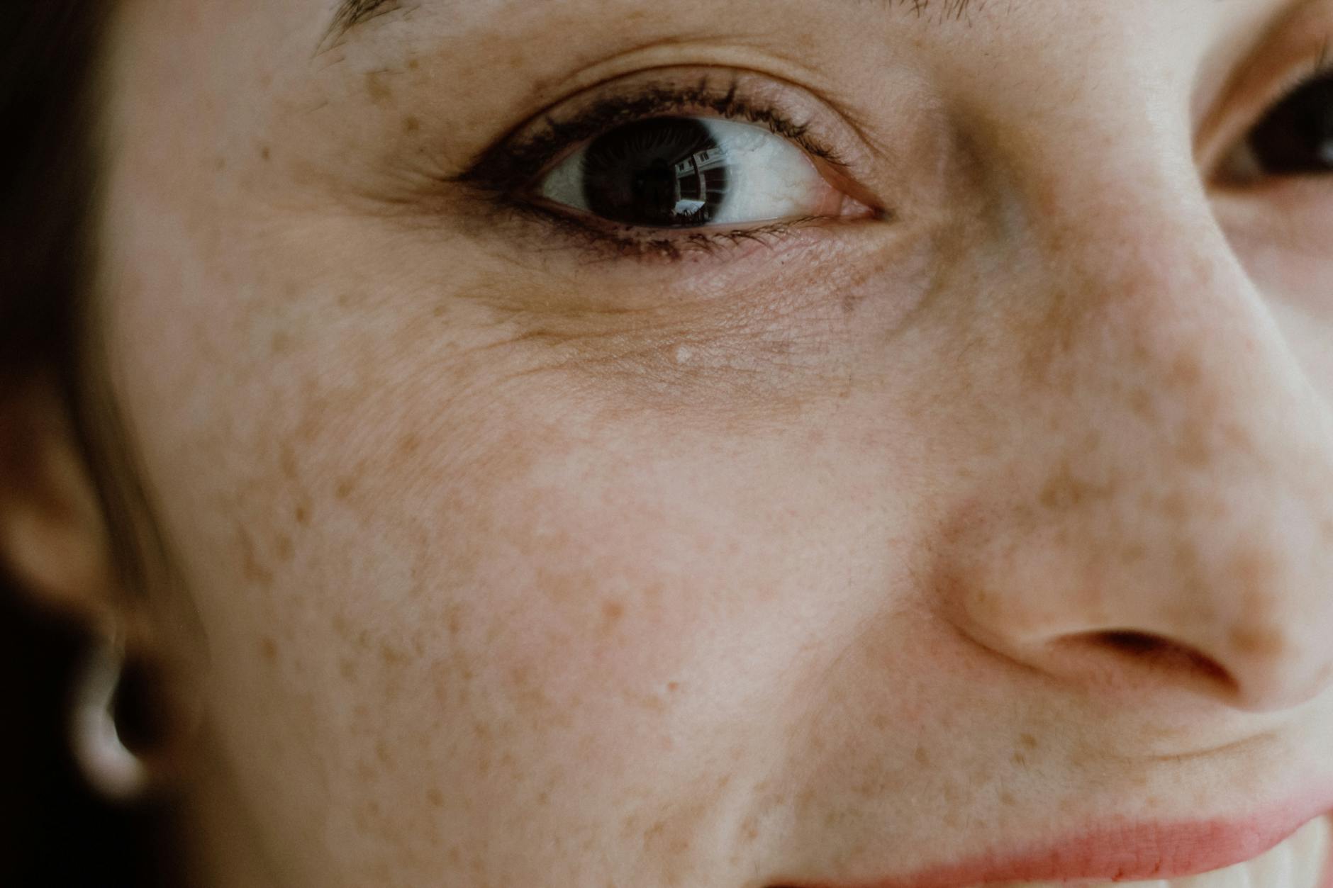 What Retinoids Actually Do to Pore Appearance