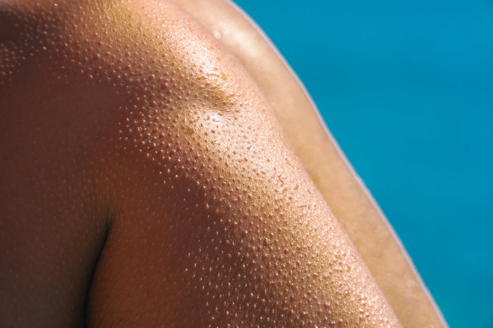 Why Is Pore Size Genetically Determined and What Does That Actually Mean?