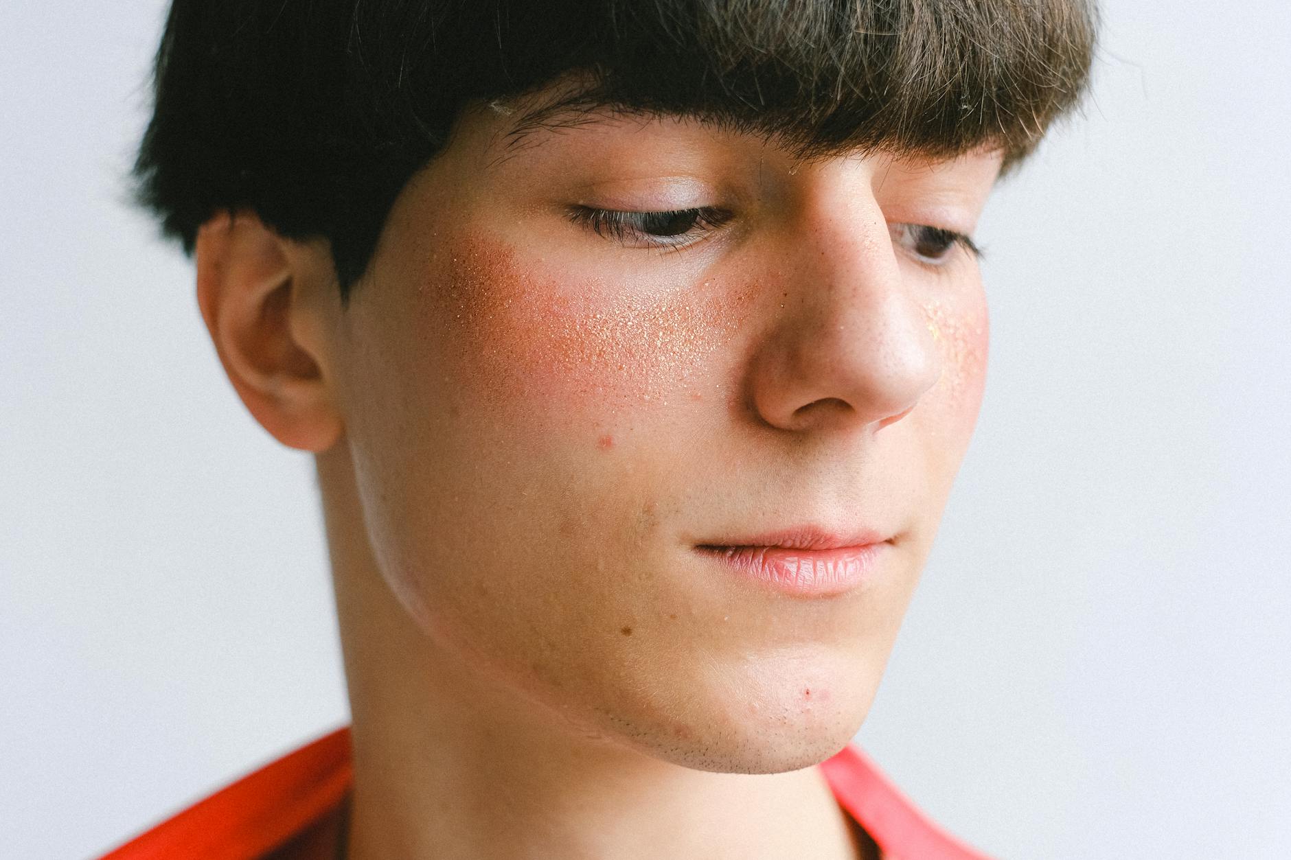 Why Perioral Dermatitis Is Often Mistaken for Acne Around the Mouth