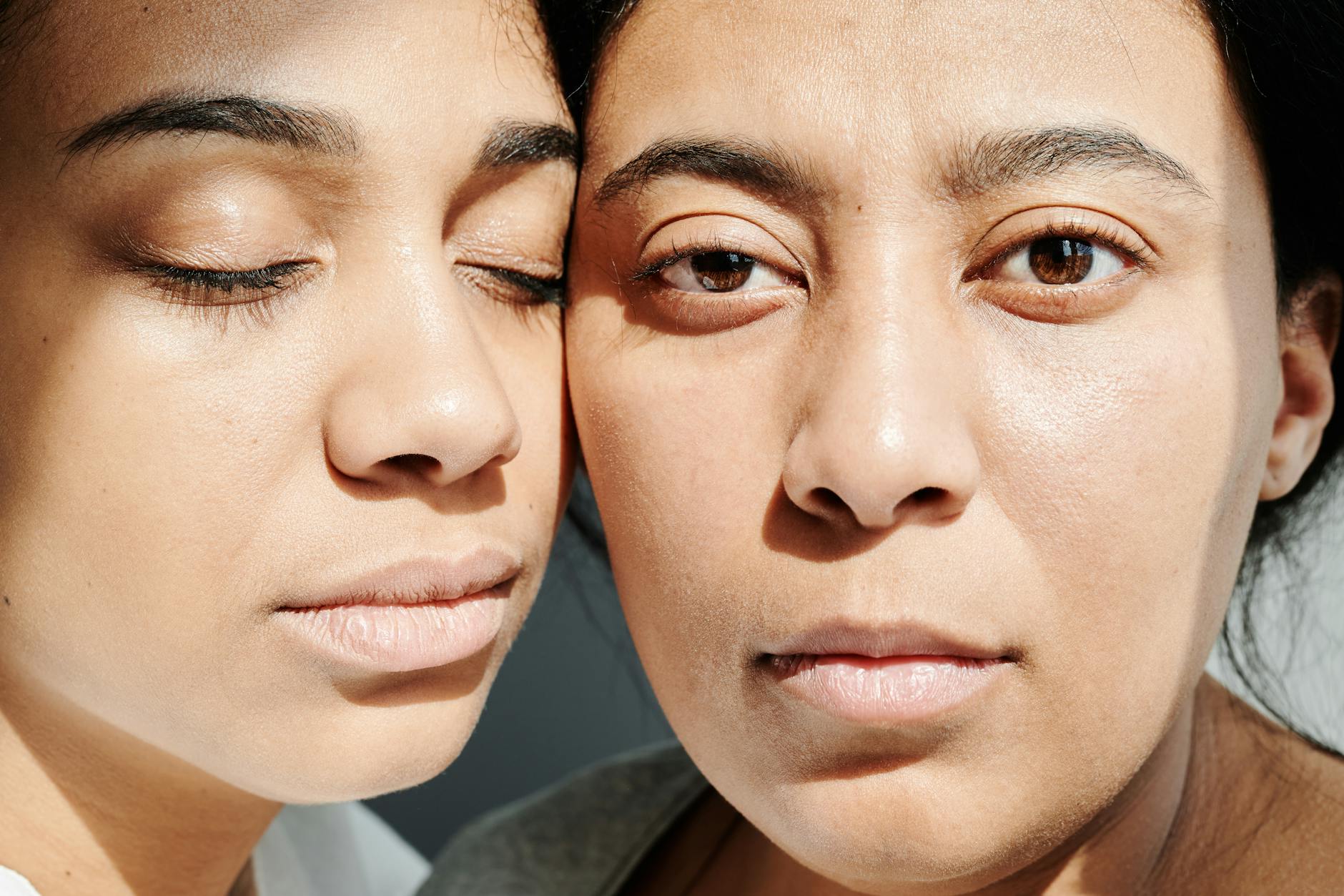 Why Women With Hormonal Acne Remain Unaware That Scars Can Be Treated