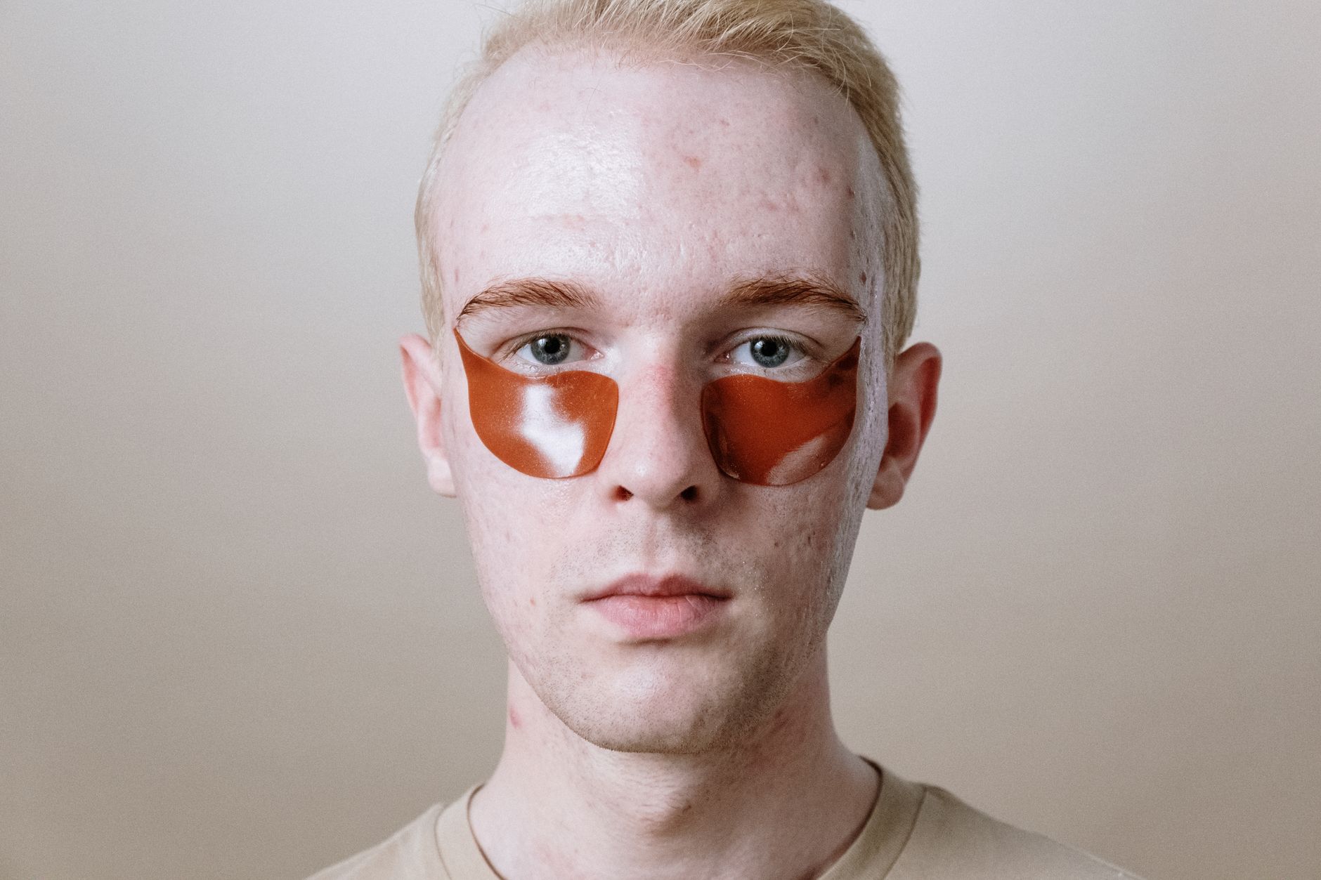 Acne Mark Treatment: Alite's New Science-Based Solution for Scar Removal - Featured image