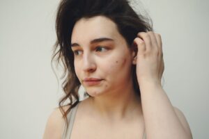 Body Acne in Hot Weather: Best Washes for Chest Back and Shoulders - Featured image