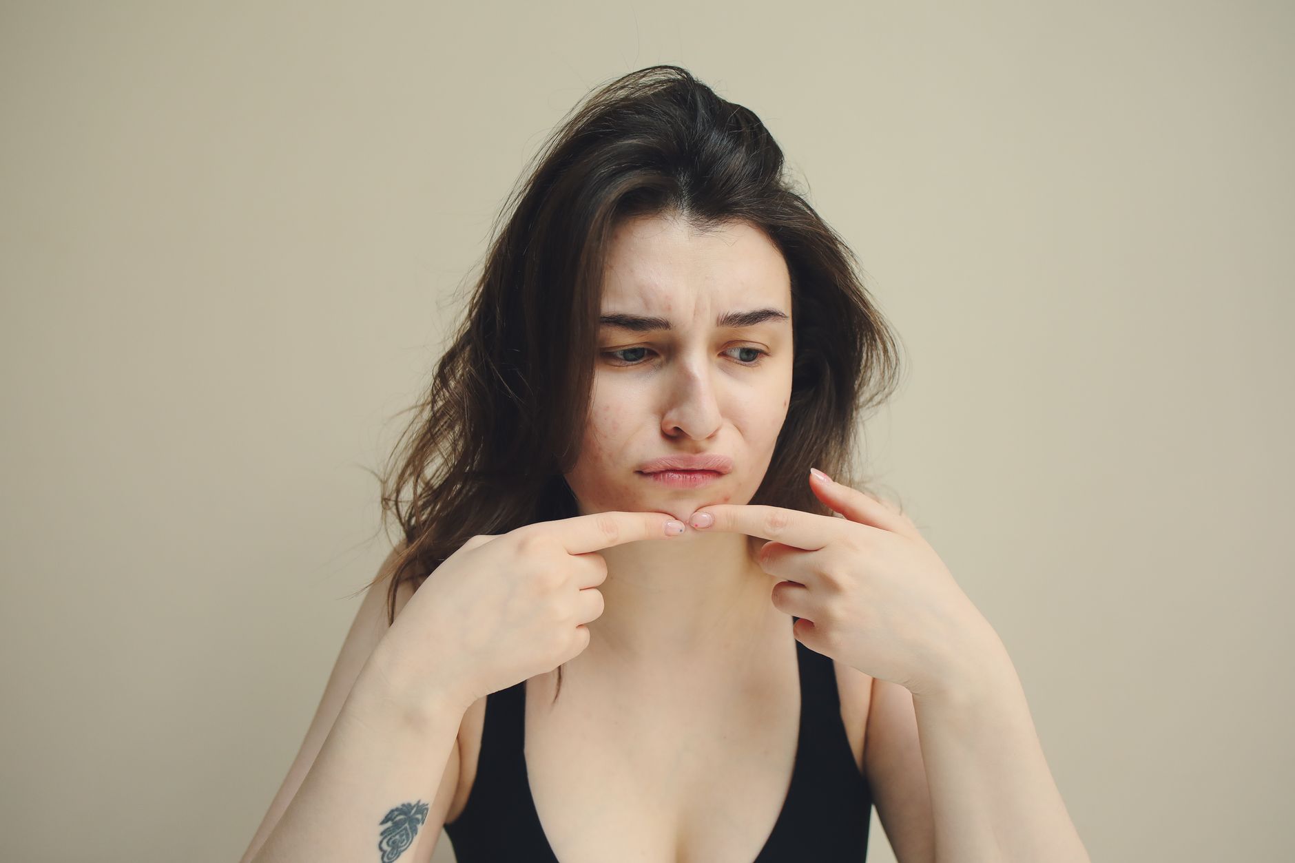 Facial Acne August 2026 Update: What Changed, Why It Matters, and What to Watch Next - Featured image