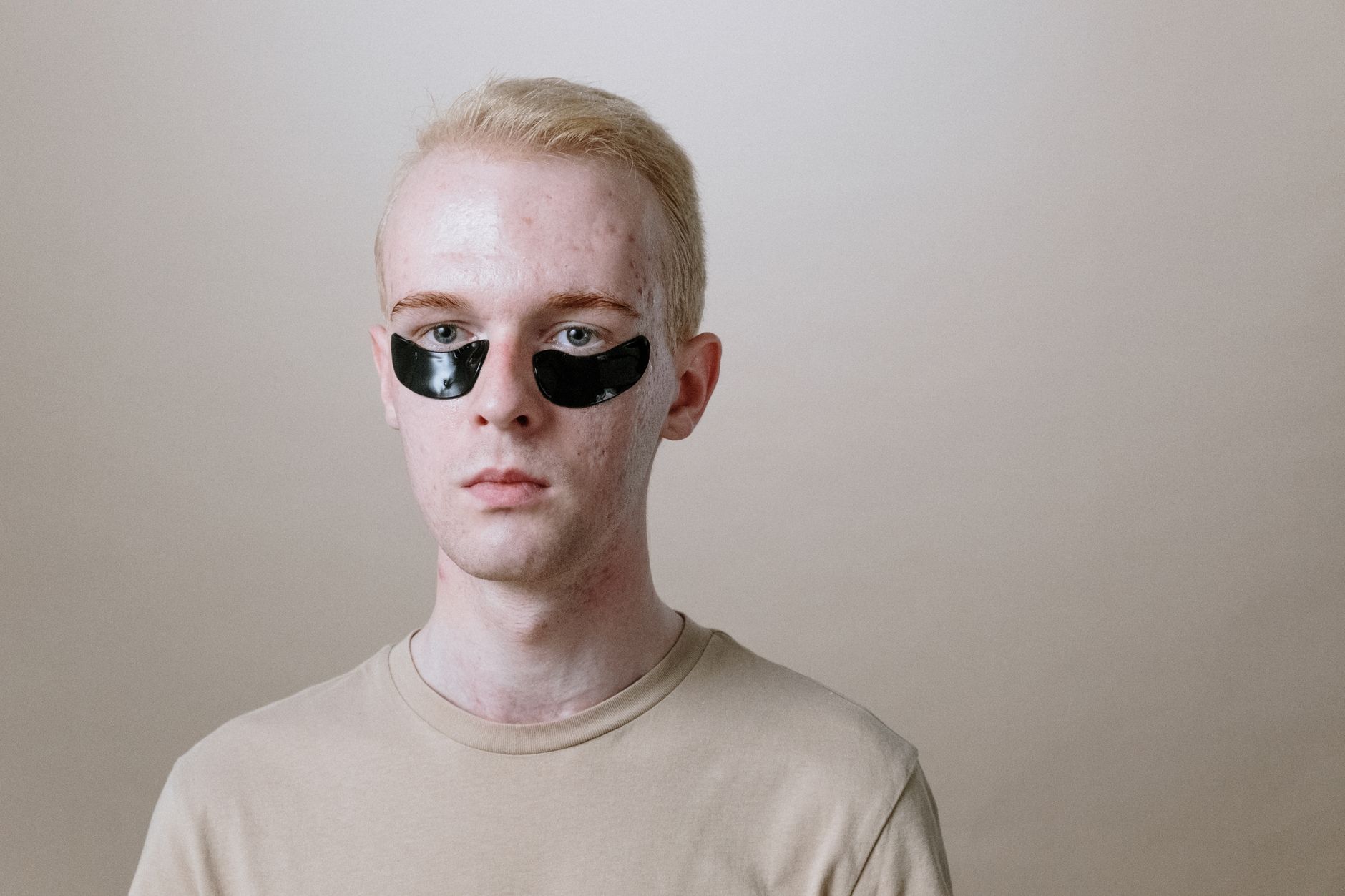 Teen Acne August 2026 Update: What Changed, Why It Matters, and What to Watch Next - Featured image