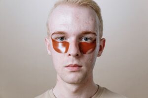 Lifestyle and Acne FAQ for September 2026: Source-Checked Answers to Common Questions - Featured image