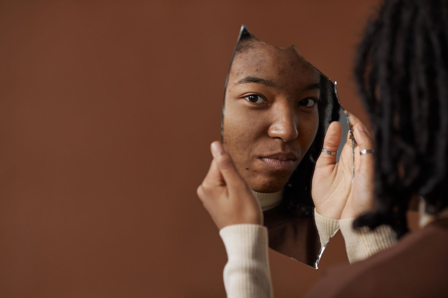 Acne Diet: Benefits, Risks, and Questions for a Clinician - Featured image