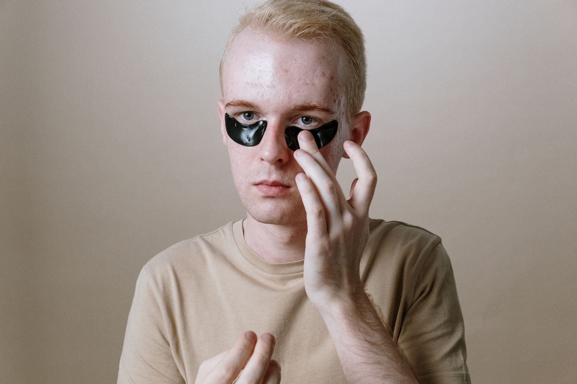 Acne Stickers Research Review: Findings, Gaps, and Practical Context - Featured image